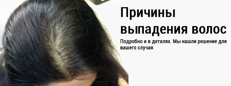 Причины выпадения волос у женщин — подробно рассказываем в этой статье и подбираем лечение